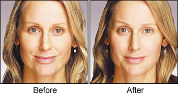 Before and After Photos